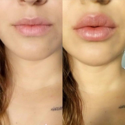 Voluminizador de labios 👄 KissMe™ - El secreto mejor guardado de las famosas🎬