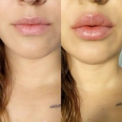 Voluminizador de labios 👄 KissMe™ - El secreto mejor guardado de las famosas🎬